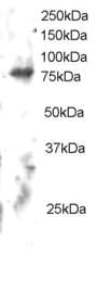 IHC-plus™ Polyclonal Goat anti-Human ELMO2 Antibody (aa707-720, IHC, WB)