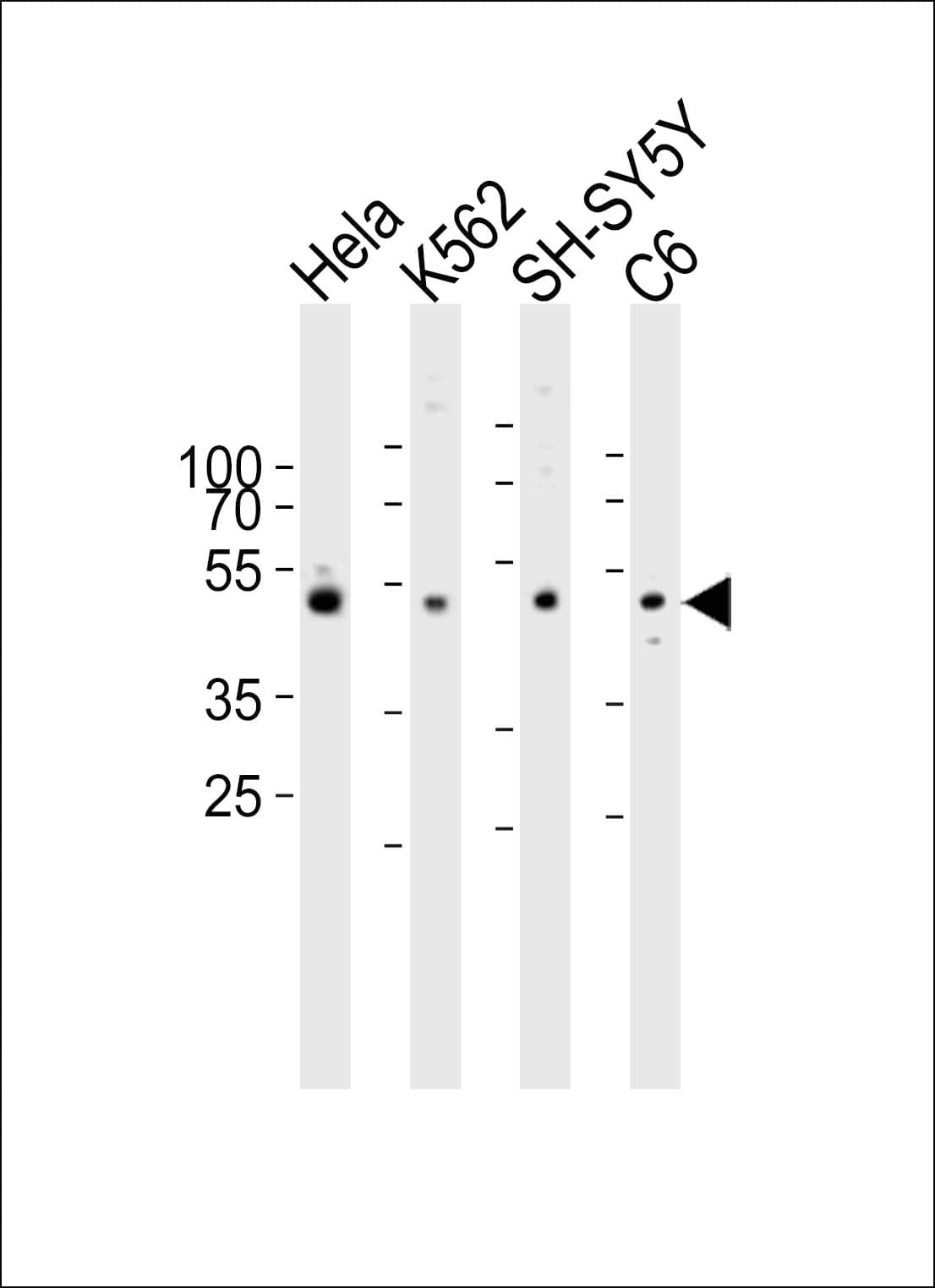 PAFAH1B1 / LIS1 Antibody (aa91-125)