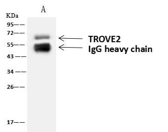 Polyclonal Rabbit anti-Human TROVE2 Antibody (IF, WB)