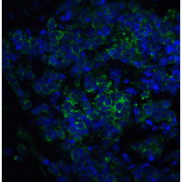 IL1RL1 Antibody