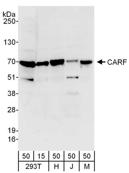 CARF / ALS2CR8 Antibody (aa1-50)