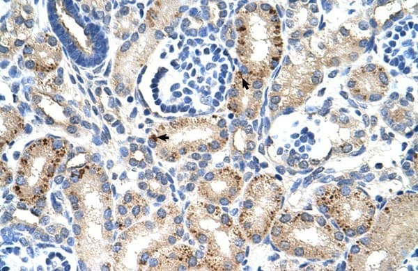 EMA / MUC1 Antibody (aa1192-1241)