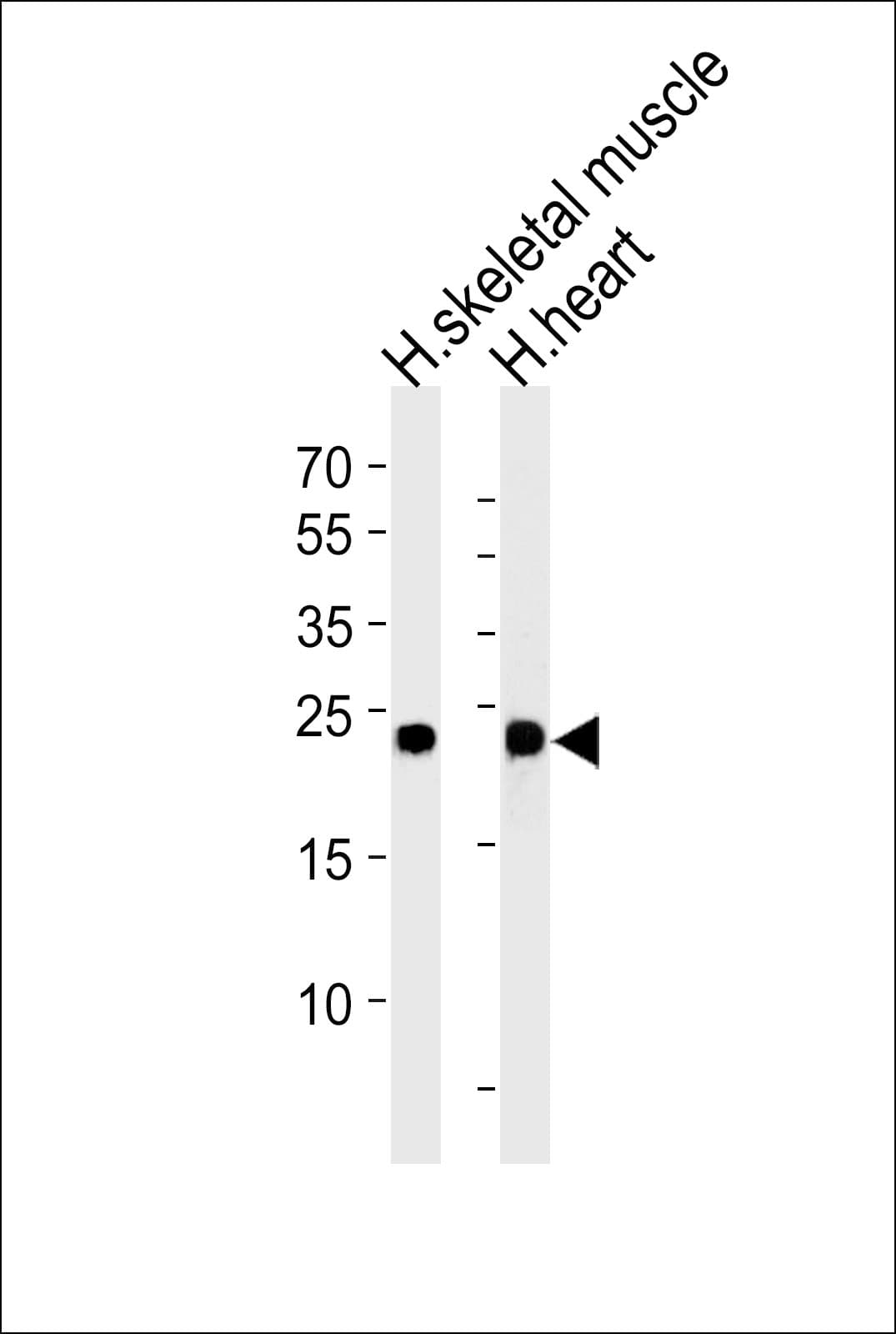 Polyclonal Rabbit anti-Human MYL3 Antibody (aa1-30, IHC, WB)