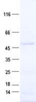 Human BPOZ / ABTB1 Protein (Recombinant His, N-Terminal)