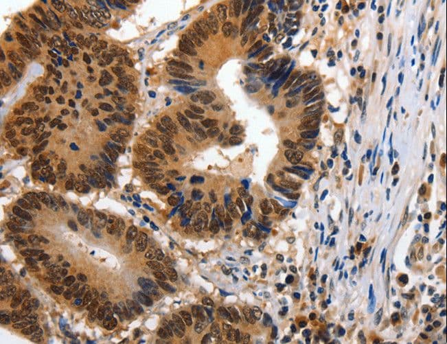 YWHAE / 14-3-3 Epsilon Antibody