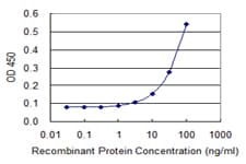 GAD65 Antibody (clone 3G3)
