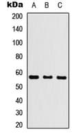 Polyclonal Rabbit anti-Human CYP26C1 Antibody (N-Terminus, IHC, WB)