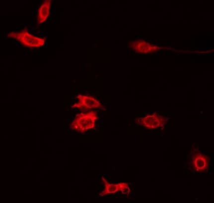 Polyclonal Rabbit anti-Human PXMP4 Antibody (IF, WB)