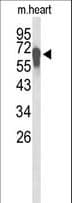 FBXL5 / FBL5 Antibody (aa86-115)