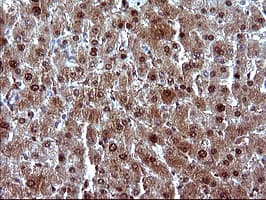 UPRT Antibody (clone OTI2D1)