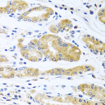 Polyclonal Rabbit anti-Human APOE / Apolipoprotein E Antibody (AP, IHC, IF)