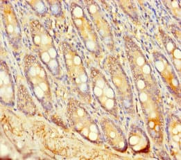 Polyclonal Rabbit anti-Human UGT2A3 Antibody