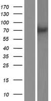 Human PPEF / PPEF1 Protein (Over-Expression Lysate Myc-DDK (Flag))