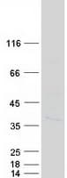 Human CENPP Protein (Recombinant Myc-DDK (Flag))