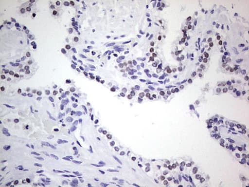 Monoclonal Mouse anti-Human NKX3-1 Antibody (clone OTI9H7, IHC, WB)