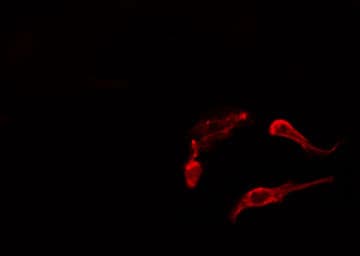 Polyclonal Rabbit anti-Human AKAP5 / AKAP79 Antibody (IF, WB)