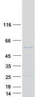 Human RNPEPL1 Protein (Recombinant Myc-DDK (Flag))