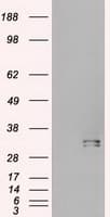 HHEX / HEX Antibody (clone OTI4B7)