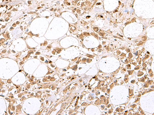RBFOX2 / RBM9 Antibody