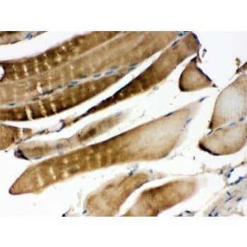 Polyclonal Rabbit anti-Human MAP2K3 / MEK3 / MKK3 Antibody (aa311-347, IHC, WB)