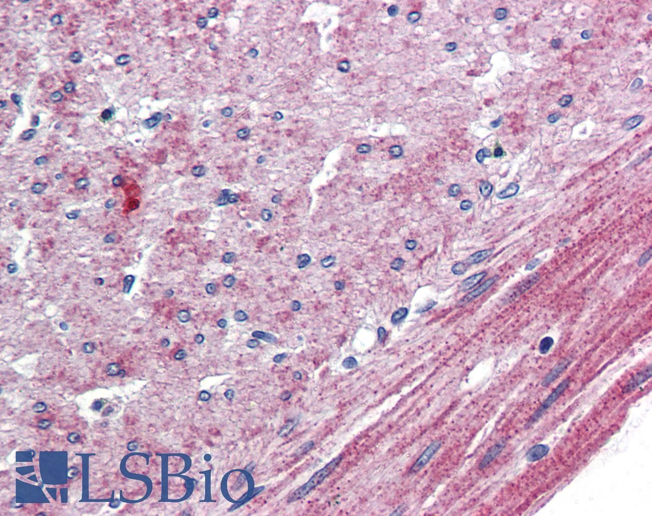 IHC-plus™ Polyclonal Rabbit anti-Human ADGRL4 / ELTD1 Antibody (N-Terminus, IHC)