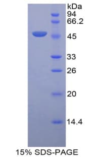 Rat LRG1 / LRG Protein (Recombinant His-GST)