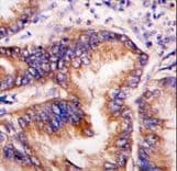 Polyclonal Rabbit anti-Human EIF2AK1 Antibody (aa267-296, IHC, WB)