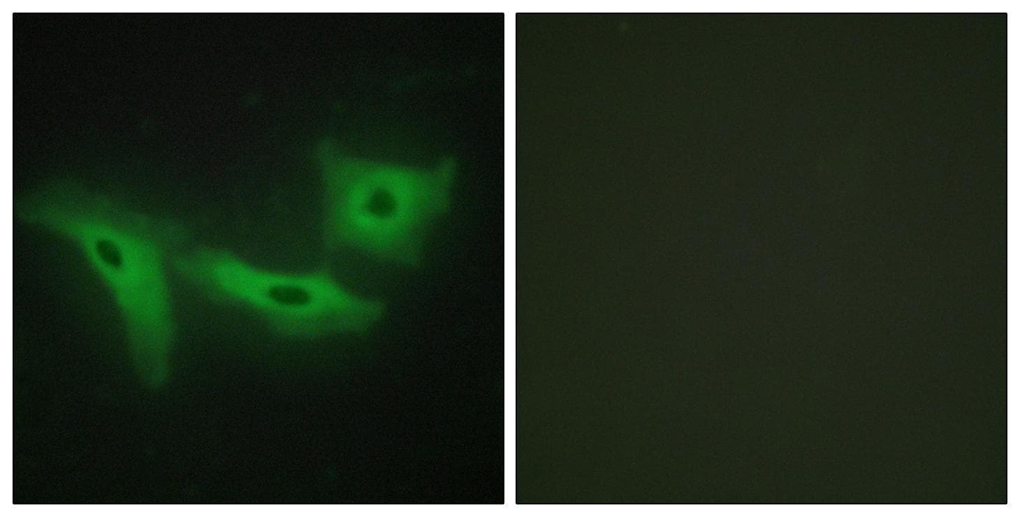 LRRK1 Antibody