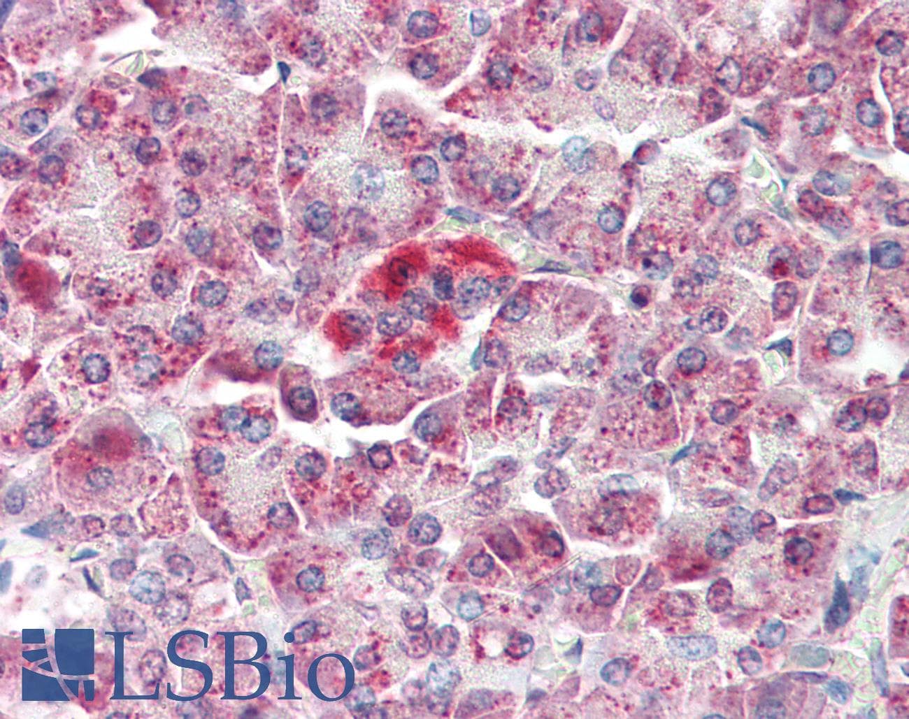 IHC-plus™ MAP3K5 / ASK1 Antibody