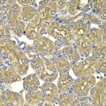 PSMD5 Antibody