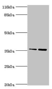 Polyclonal Rabbit anti-Human CFHR2 Antibody (IHC, WB)