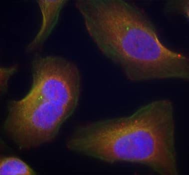 PRKCQ / PKC-Theta Antibody (phospho-Ser676)
