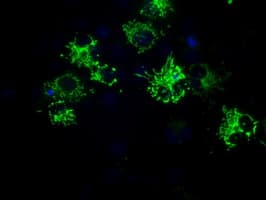 Monoclonal Mouse anti-Human HMRF1L / MTRF1L Antibody (clone OTI1H5, IHC, IF, WB)