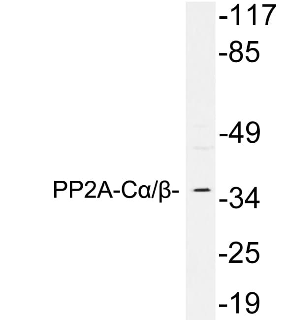 PP2A Alpha + Beta Antibody (aa258-307)