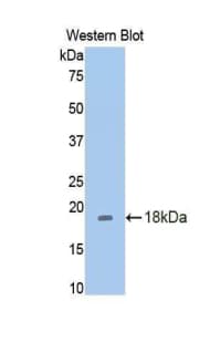 REN / Renin 1 Antibody (aa275-389)