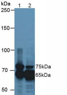 TGFBI Antibody (aa423-632)