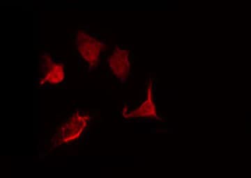 Polyclonal Rabbit anti-Human HNRNPK / hnRNP K Antibody (IF, WB)