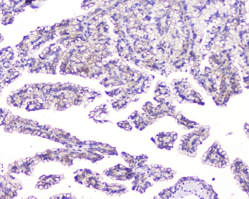 Polyclonal Rabbit anti-Human FAM176A / TMEM166 Antibody (IHC, WB)