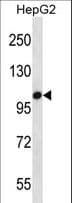 Polyclonal Rabbit anti-Human TLR7 / CD287 Antibody (aa899-926, WB)
