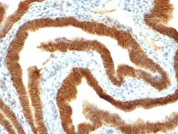 EPCAM Antibody (clone MOC-31)