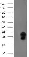 FGF21 Antibody (aa29-209, clone OTI2B9)