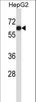 Polyclonal Rabbit anti-Human AMIGO Antibody (aa386-415, WB)