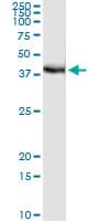 FRG1 Antibody (clone 4A5)