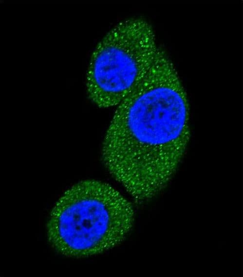 PIK3C3 / VPS34 Antibody (aa24-53)
