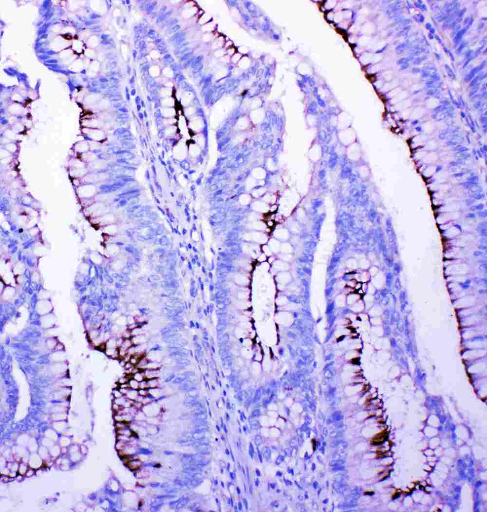 Polyclonal Rabbit anti-Human PFN2 / Profilin 2 Antibody (aa125-140, IHC, WB)