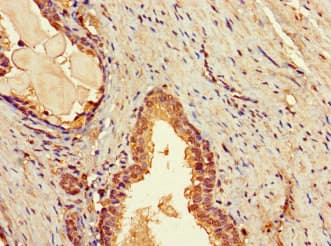 TBC1D7 Antibody
