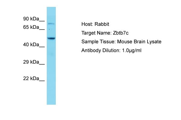 Polyclonal Rabbit anti-Mouse ZBTB7C Antibody (aa181-230, WB)