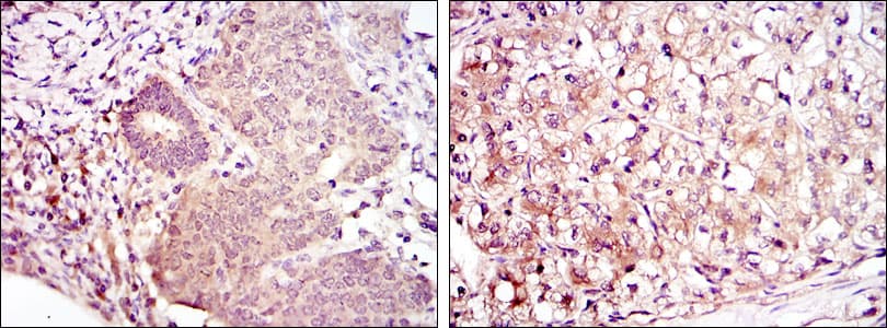 MAP2K6 / MEK6 / MKK6 Antibody (clone 3H12B9)