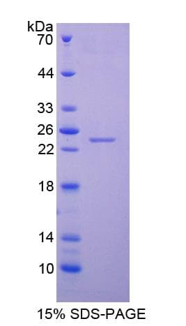 Pig LCN2 / Lipocalin 2 / NGAL Protein (Recombinant His-T7)
