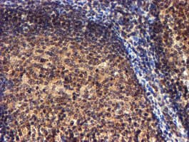 Monoclonal Mouse anti-Human RFXANK Antibody (clone OTI2B6, IHC, IF, WB)